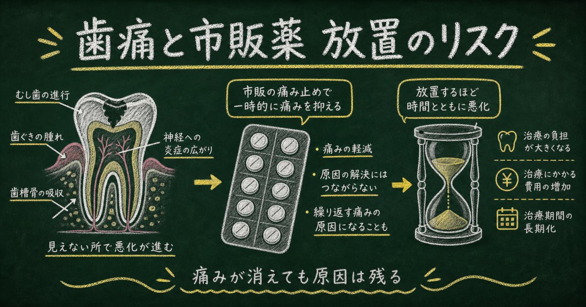 歯痛を市販薬で放置する危険性とは？知るべき3つのリスクと受診目安