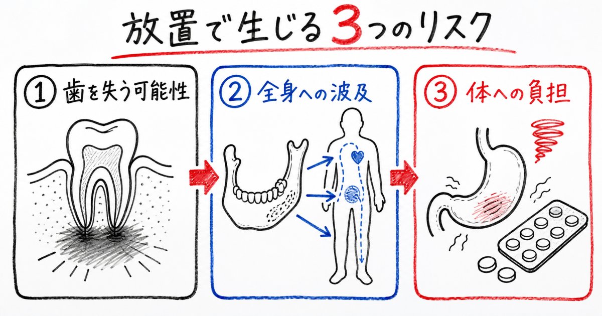 歯痛を市販薬で放置することで生じる3つの重大リスク