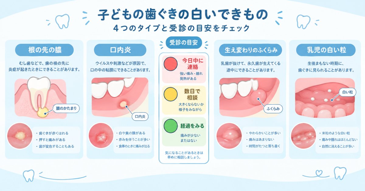 子供の歯茎に白いできもの発見、受診の緊急度を見極める方法