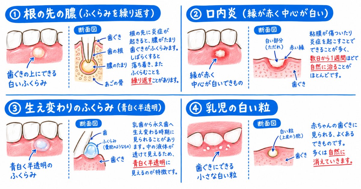 白いできものの正体を見分ける代表的な4つのタイプ